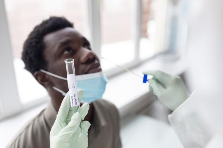 UNIMED LABORATÓRIO: Procura por testes de Covid-19 aumenta cinco vezes 
