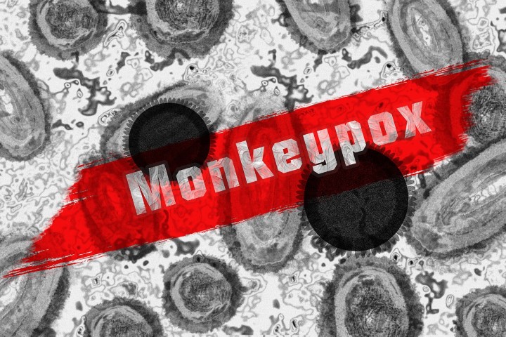 SAÚDE: Secretaria confirma 4 novos casos de Monkeypox; não há registro de mortes