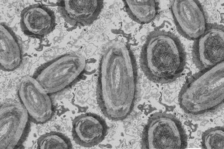 SAÚDE: Secretaria confirma dois novos casos de Mpox no Paraná